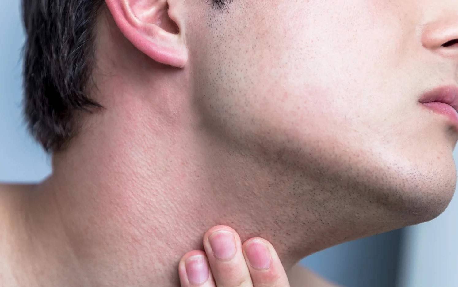A man with razor burn on his neck